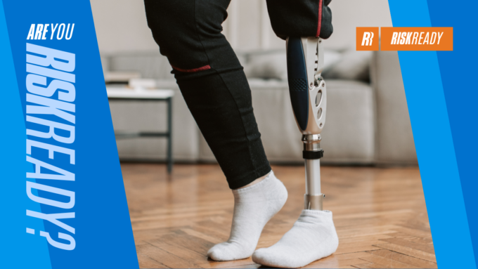Are You Risk Ready? Amputated leg